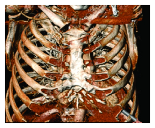 Details are in the caption following the image