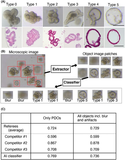 Integration of human inspection and artificial intelligence-based morphological typing of patient-derived organoids reveals interpatient heterogeneity of colorectal cancer