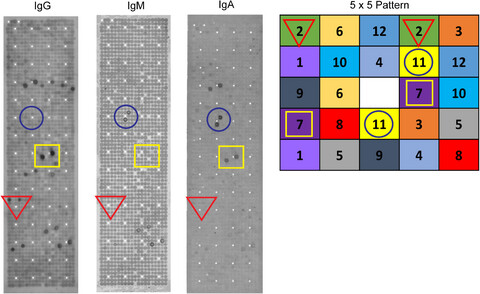 IgM and IgA augmented autoantibody signatures improve early-stage detection of colorectal cancer prior to nodal and distant spread