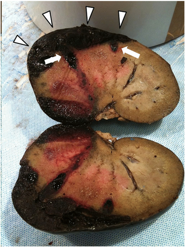 Details are in the caption following the image Details are in the caption following the image