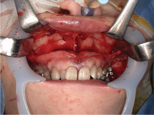 Details are in the caption following the image Details are in the caption following the image
