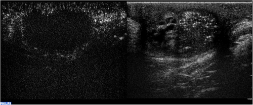 Details are in the caption following the image