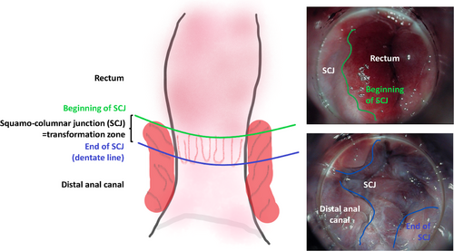 Details are in the caption following the image Details are in the caption following the image
