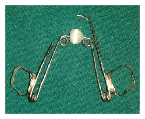 Details are in the caption following the image Details are in the caption following the image