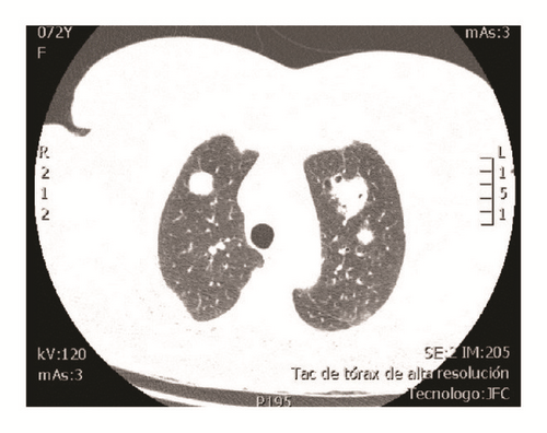 Details are in the caption following the image