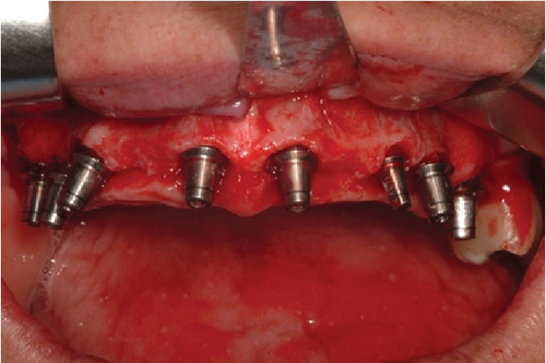 Details are in the caption following the image Details are in the caption following the image