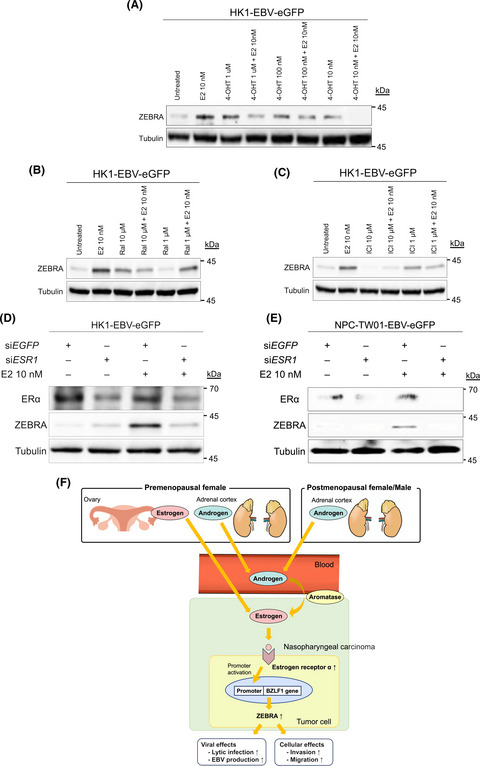Estrogen induces the expression of EBV lytic protein ZEBRA, a marker of poor prognosis in nasopharyngeal carcinoma