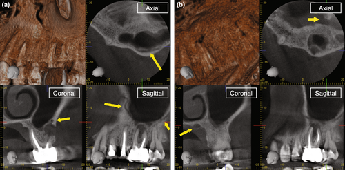 Details are in the caption following the image Details are in the caption following the image