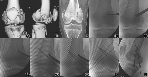 Details are in the caption following the image Details are in the caption following the image