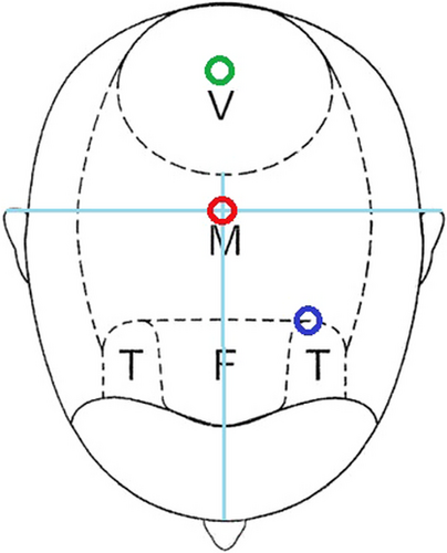 Details are in the caption following the image