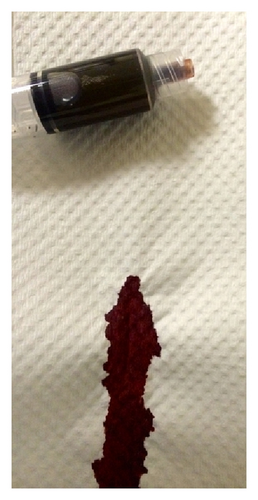 Details are in the caption following the image