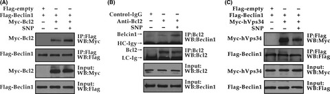 Nitric oxide inhibits autophagy and promotes apoptosis in hepatocellular carcinoma