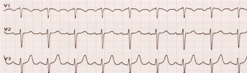 Details are in the caption following the image