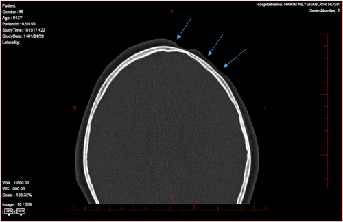 Details are in the caption following the image Details are in the caption following the image