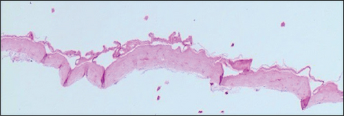 Details are in the caption following the image