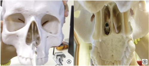 Details are in the caption following the image Details are in the caption following the image