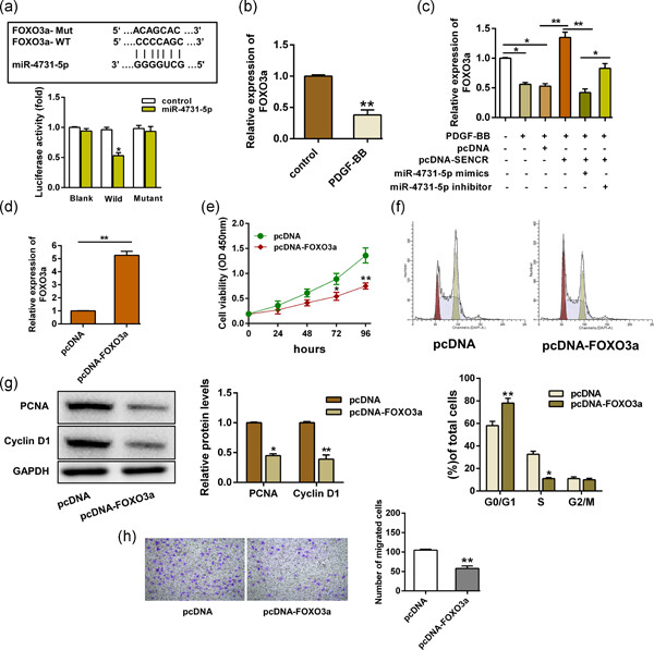 Preliminary study on the mechanism of long noncoding RNA SENCR regulating the proliferation and migration of vascular smooth muscle cells