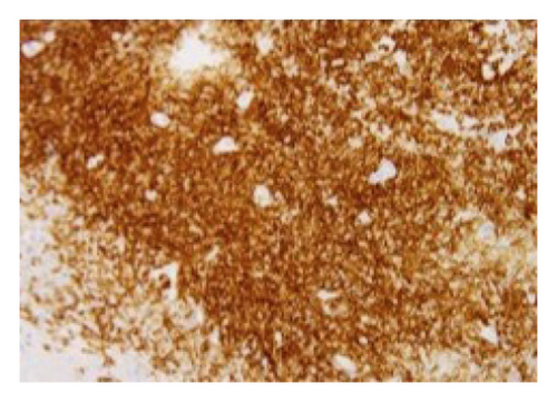 Details are in the caption following the image