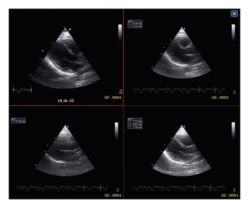 Details are in the caption following the image Details are in the caption following the image