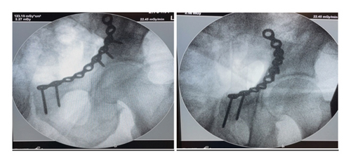 Details are in the caption following the image Details are in the caption following the image