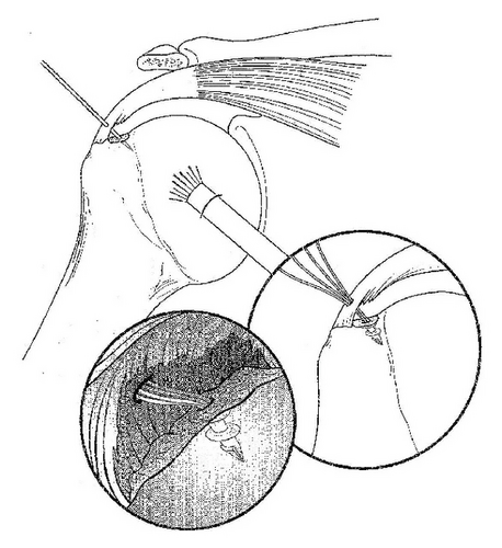 Details are in the caption following the image