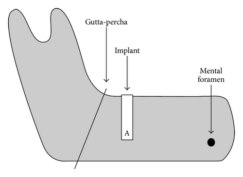Details are in the caption following the image