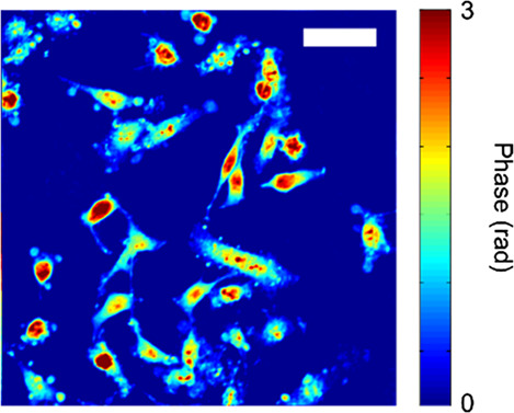 Molecular and biophysical analysis of apoptosis using a combined quantitative phase imaging and fluorescence resonance energy transfer microscope