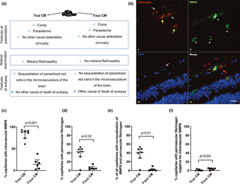 Localised release of matrix metallopeptidase 8 in fatal cerebral malaria