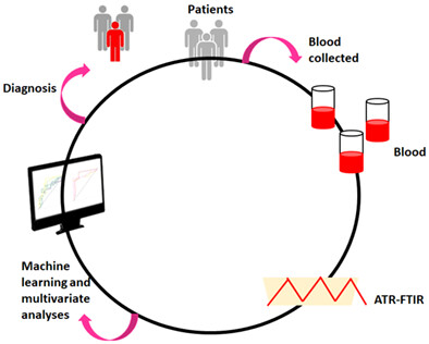 Application of Fourier transform infrared spectroscopy to detect biochemical changes in blood serum of obese patients