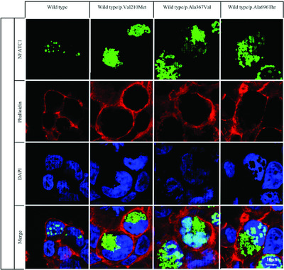 Heterozygous missense mutations in NFATC1 are associated with atrioventricular septal defect