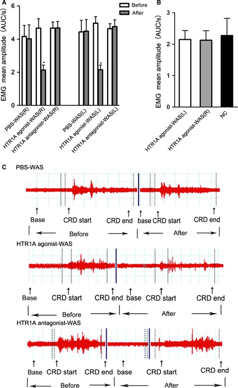 Role of 5-HT1A receptor in insular cortex mediating stress – induced visceral sensory dysfunction