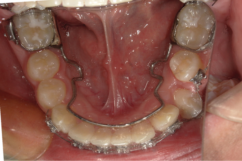 Details are in the caption following the image Details are in the caption following the image