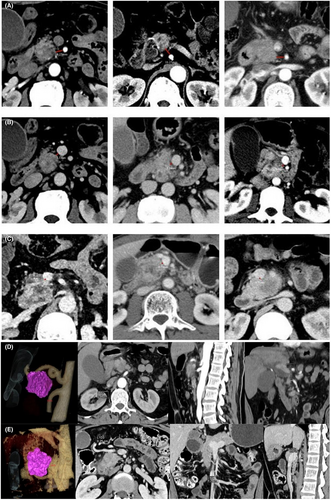 Details are in the caption following the image Details are in the caption following the image