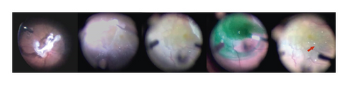 Details are in the caption following the image Details are in the caption following the image