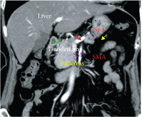 Details are in the caption following the image
