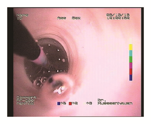 Details are in the caption following the image