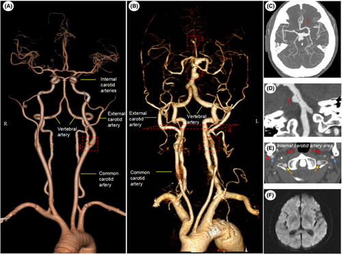 Details are in the caption following the image Details are in the caption following the image