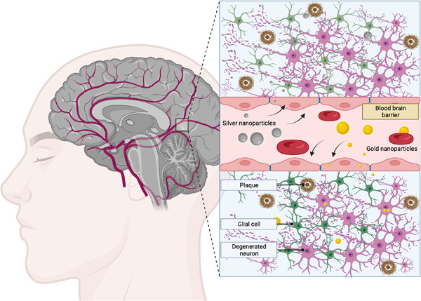 Gold and silver nanoparticles in Alzheimer's and Parkinson's diagnostics and treatments