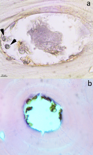 Details are in the caption following the image