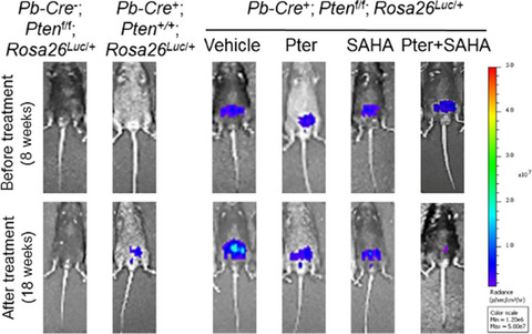 Targeting MTA1/HIF-1α signaling by pterostilbene in combination with histone deacetylase inhibitor attenuates prostate cancer progression