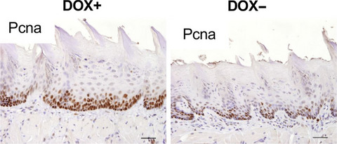 Promotion of cell proliferation by the proto-oncogene DEK enhances oral squamous cell carcinogenesis through field cancerization