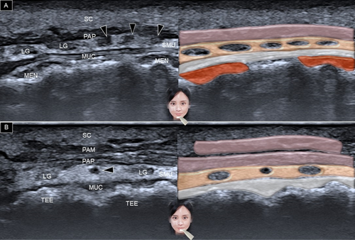 Details are in the caption following the image Details are in the caption following the image