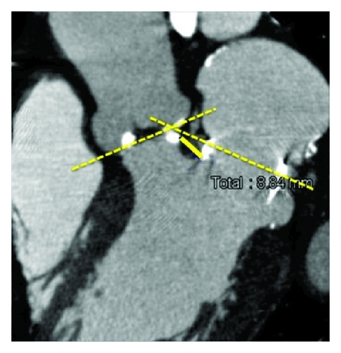 Details are in the caption following the image