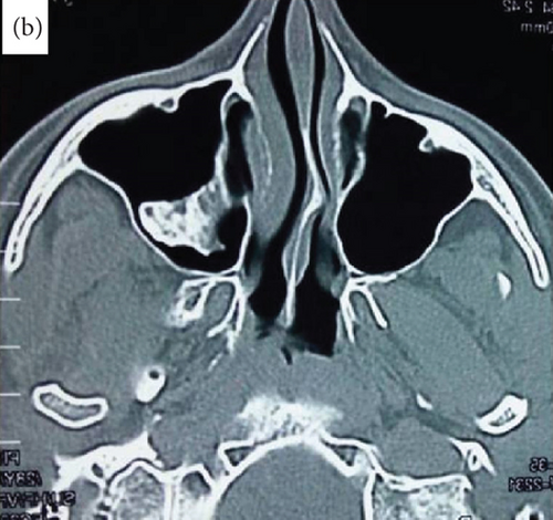 Details are in the caption following the image Details are in the caption following the image