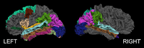 Accelerated age-related cortical thinning in mild traumatic brain injury