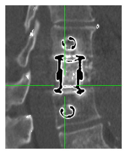 Details are in the caption following the image