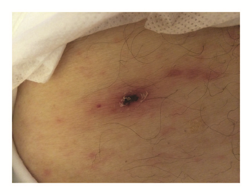 Details are in the caption following the image Details are in the caption following the image