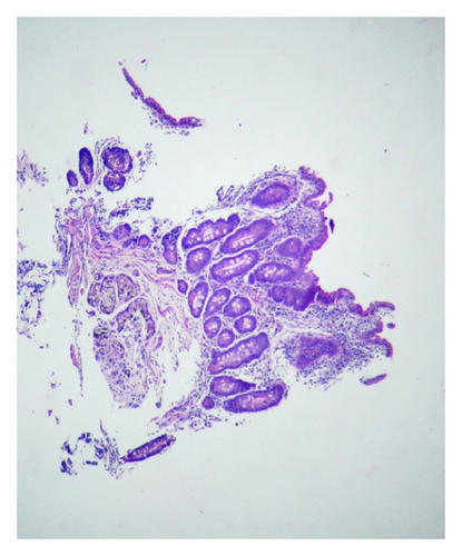 Details are in the caption following the image