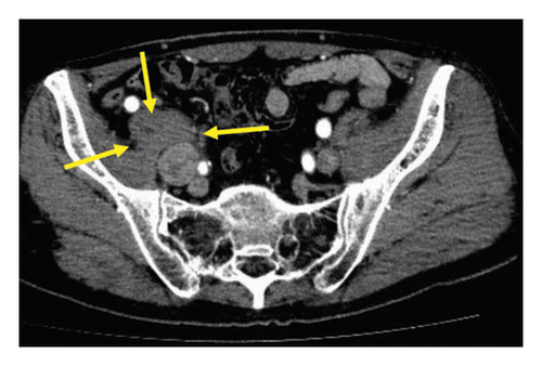 Details are in the caption following the image Details are in the caption following the image