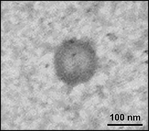 Details are in the caption following the image